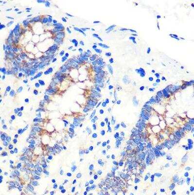 Immunohistochemistry-Paraffin: SCO2 Antibody [NBP2-94525] - Human colon using SCO2 Rabbit pAb at dilution of 1:100 (40x lens).