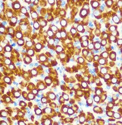 Immunohistochemistry-Paraffin: SCO2 Antibody [NBP2-94525] - Rat ovary using SCO2 Rabbit pAb at dilution of 1:100 (40x lens).