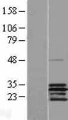 Western Blot: SCO2 Overexpression Lysate (Adult Normal) [NBP2-07787] Left-Empty vector transfected control cell lysate (HEK293 cell lysate); Right -Over-expression Lysate for SCO2.