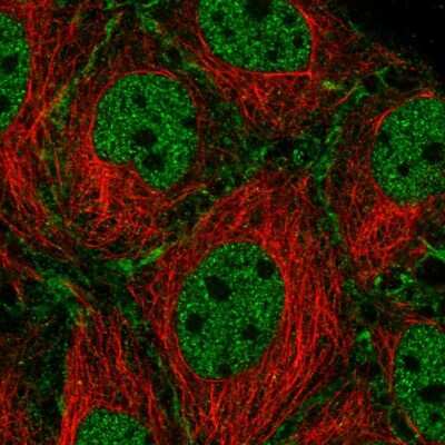 Immunocytochemistry/ Immunofluorescence SCP2/SYCP2 Antibody