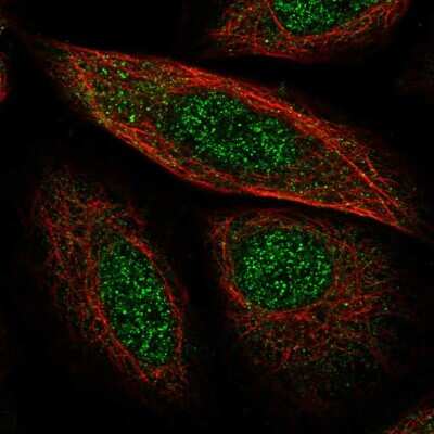 Immunocytochemistry/ Immunofluorescence SCP2/SYCP2 Antibody