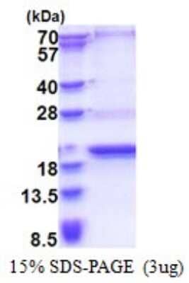 SDS-Page: SCP2D1 Recombinant Protein [NBP2-51634] - 15% SDS Page (3 ug)