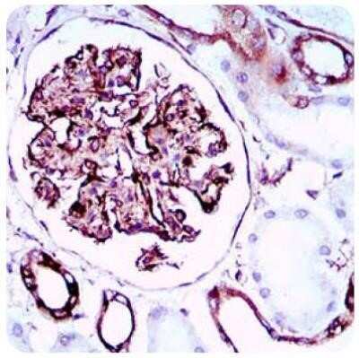 Immunohistochemistry-Paraffin: SCP3/SYCP3 Antibody (6F9C5) - Azide and BSA Free [NBP2-80942] - Analysis of paraffin-embedded kidney tissues using SYCP3 mouse mAb with DAB staining. Image from the standard format of this antibody.