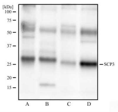 Western Blot: SCP3/SYCP3 Antibody (6F9C5) - Azide and BSA Free [NBP2-80942] - Analysis of human testis tissue (A), human ovary tissue (B), mouse testis tissue (C), and mouse ovary tissue (D) using SCP3 antibody at 2 ug/ml. Image from the standard format of this antibody.