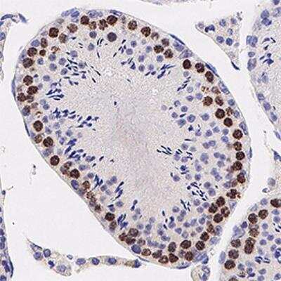 Immunohistochemistry-Paraffin: SCP3/SYCP3 Antibody [NB300-230] - Analysis of human testis using SCP3 antibody at 1:500 on a Bond Rx autostainer (Leica Biosystems). The assay involved 20 minutes of heat induced antigen retrieval (HIER) using 10mM sodium citrate buffer (pH 6.0) and endogenous peroxidase quenching with peroxide block. The sections were incubated with primary antibody for 30 minutes and Bond Polymer Refine Detection (Leica Biosystems) with DAB was used for signal development followed by counterstaining with hematoxylin. Whole slide scanning and capturing of representative images was performed using Aperio AT2 (Leica Biosystems). Nuclear staining was observed. Staining was performed by Histowiz.