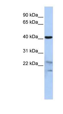 Western Blot: SCRN2 Antibody [NBP1-56896] - HepG2 cell lysate, concentration 0.2-1 ug/ml.