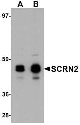 Western Blot SCRN2 Antibody - BSA Free