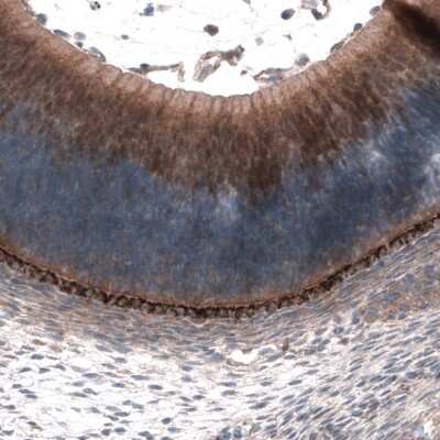 Immunohistochemistry-Paraffin SCRT1 Antibody - BSA Free