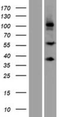 Western Blot SCUBE3 Overexpression Lysate