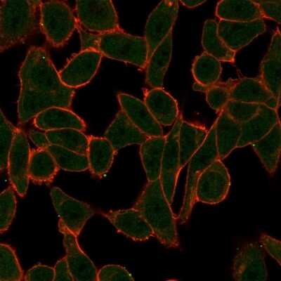 Immunocytochemistry/Immunofluorescence: SCX Antibody (PCRP-SCXA-2D11) [NBP3-08516] - Immunofluorescence Analysis of HeLa cells using SCX Mouse Monoclonal Antibody (PCRP-SCXA-2D11) followed by goat anti- Mouse IgG-CF488 (green). CF640A phalloidin (red).