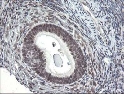 Immunohistochemistry: SCYL1BP1 Antibody (4F11) [NBP2-45912] - Analysis of Human Ovary tissue.