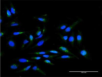 Immunocytochemistry/Immunofluorescence: SCYL1BP1 Antibody [H00092344-B01P] - Analysis of purified antibody to SCYL1BP1 on HeLa cell. (antibody concentration 10 ug/ml)