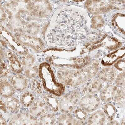 Immunohistochemistry-Paraffin: SCYL1BP1 Antibody [NBP1-92371] - Staining of human kidney shows strong cytoplasmic positivity in cells in tubules.