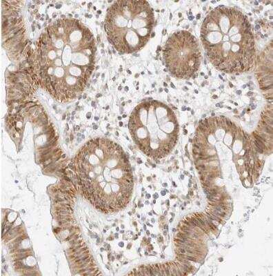 Immunohistochemistry-Paraffin: SCYL1BP1 Antibody [NBP1-92371] - Staining of human colon shows moderate cytoplasmic positivity in glandular cells.