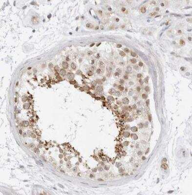 Immunohistochemistry-Paraffin: SCYL1BP1 Antibody [NBP1-92371] - Staining of human testis shows moderate cytoplasmic positivity in cells in seminifereous ducts.