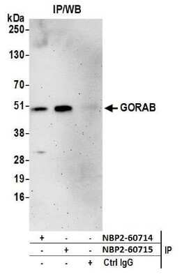 Immunoprecipitation: SCYL1BP1 Antibody [NBP2-60715] - Detection of immunoprecipitates. Samples: Whole cell lysate (0.5 or 1.0 mg per IP reaction; 20% of IP loaded) from HeLa cells prepared using NETN lysis buffer. Antibodies: Affinity purified rabbit anti-GORAB antibody NBP2-60715 used for IP at 8 ul per reaction. GORAB was also immunoprecipitated by rabbit anti-GORAB antibody NBP2-60714. For blotting immunoprecipitated GORAB, NBP2-60715 was used at 1:1000. Detection: Chemiluminescence with an exposure time of 3 minutes.