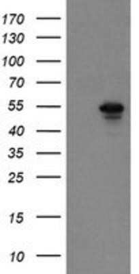 Western Blot: SCYL1BP1 Antibody (OTI2H6) - Azide and BSA Free [NBP2-74030] - HEK293T cells were transfected with the pCMV6-ENTRY control (Left lane) or pCMV6-ENTRY SCYL1BP1 (Right lane) cDNA for 48 hrs and lysed. Equivalent amounts of cell lysates (5 ug per lane) were separated by SDS-PAGE and immunoblotted with anti-SCYL1BP1.
