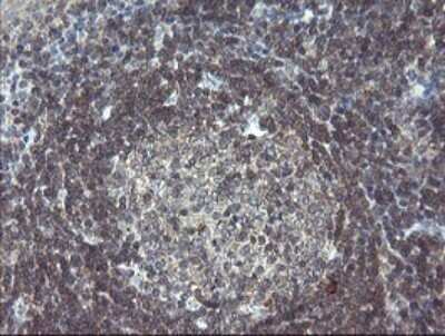 Immunohistochemistry: SCYL1BP1 Antibody (OTI4F11) - Azide and BSA Free [NBP2-74029] - Analysis of Human tonsil tissue.