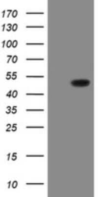 Western Blot: SCYL1BP1 Antibody (OTI4F11) - Azide and BSA Free [NBP2-74029] - Analysis of HEK293T cells were transfected with the pCMV6-ENTRY control (Left lane) or pCMV6-ENTRY SCYL1BP1.