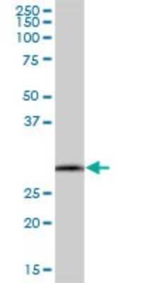 Western Blot: SCYL1BP1 Antibody [H00092344-B01P] - Analysis of SCYL1BP1 expression in human colon.