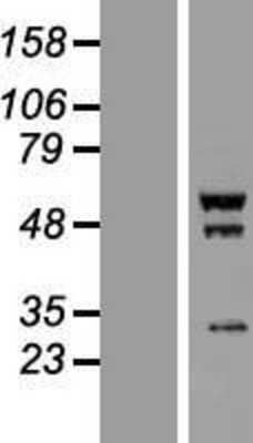 Western Blot: SCYL1BP1 Overexpression Lysate (Adult Normal) [NBP2-05418] Left-Empty vector transfected control cell lysate (HEK293 cell lysate); Right -Over-expression Lysate for SCYL1BP1.