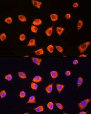 Immunocytochemistry/Immunofluorescence: SCYL2 Antibody [NBP2-93622] - Immunofluorescence analysis of L929 cells using SCYL2 Rabbit pAb (NBP2-93622) at dilution of 1:100. Blue: DAPI for nuclear staining.