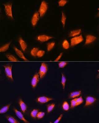 Immunocytochemistry/Immunofluorescence: SCYL2 Antibody [NBP2-93622] - Immunofluorescence analysis of U2OS cells using SCYL2 Rabbit pAb (NBP2-93622) at dilution of 1:100. Blue: DAPI for nuclear staining.