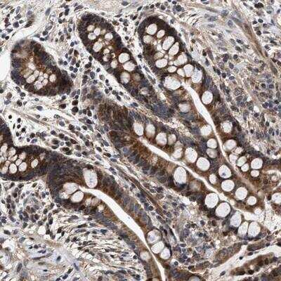 Immunohistochemistry-Paraffin: SCYL2 Antibody [NBP1-81416] - Staining of human colon shows granular positivity in glandular cells.
