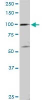 Western Blot: SCYL2 Antibody [H00055681-D01P] - Analysis of SCYL2 expression in Jurkat.