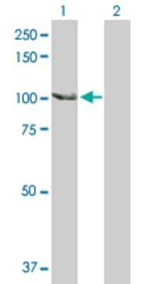 Western Blot: SCYL2 Antibody [H00055681-D01P] - Analysis of SCYL2 expression in transfected 293T cell line by SCYL2 polyclonal antibody.Lane 1: SCYL2 transfected lysate(103.70 KDa).Lane 2: Non-transfected lysate.