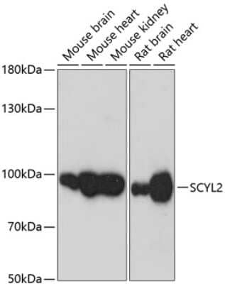 Western Blot: SCYL2 Antibody [NBP2-93622] - Analysis of extracts of various cell lines, using SCYL2 at 1:3000 dilution. Secondary antibody: HRP Goat Anti-Rabbit IgG (H+L) at 1:10000 dilution. Lysates/proteins: 25ug per lane. Blocking buffer: 3% nonfat dry milk in TBST. Detection: ECL Basic Kit . Exposure time: 30s.