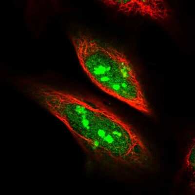 Immunocytochemistry/ Immunofluorescence SDAD1 Antibody - BSA Free