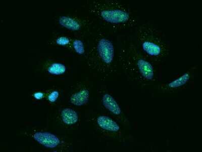 Immunocytochemistry/Immunofluorescence: SDAD1 Antibody [NBP2-98637] - Immunofluorescence staining of SDAD1 in U2OS cells. Cells were fixed with 4% PFA, permeabilzed with 0.1% Triton X-100 in PBS, blocked with 10% serum, and incubated with rabbit anti-Human SDAD1 polyclonal antibody (dilution ratio 1:200) at 4C overnight. Then cells were stained with the Alexa Fluor(R)488-conjugated Goat Anti-rabbit IgG secondary antibody (green) and counterstained with DAPI (blue).Positive staining was localized to Nucleus.