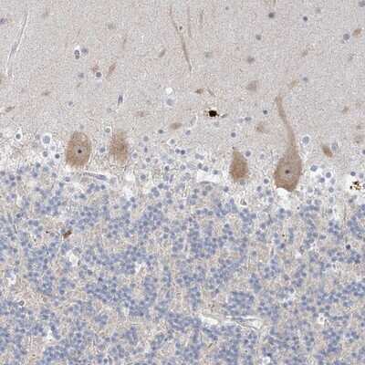 Immunohistochemistry-Paraffin SDAD1 Antibody - BSA Free