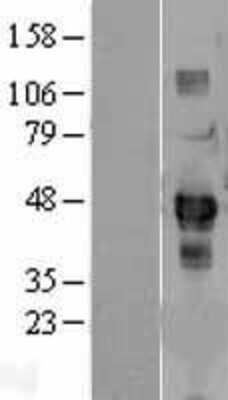 Western Blot SDCCAG3 Overexpression Lysate