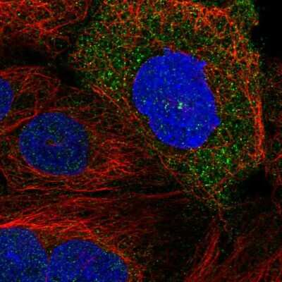 Immunocytochemistry/Immunofluorescence: SDCCAG8 Antibody [NBP2-55249] - Staining of human cell line A-431 shows localization to centrosome.