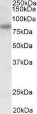 Western Blot SDCCAG8 Antibody