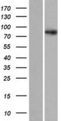 Western Blot SDCCAG8 Overexpression Lysate