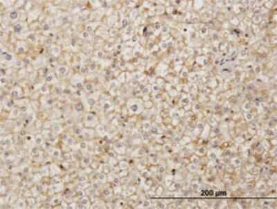 Immunohistochemistry-Paraffin SDF2 Antibody (3G7-1D6)