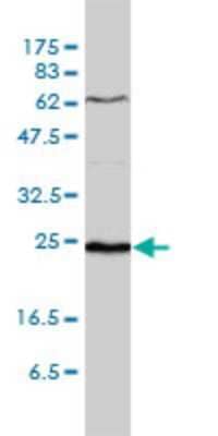 Western Blot SDF2 Antibody (3G7-1D6)