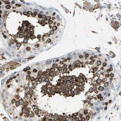 Immunohistochemistry-Paraffin SDF2L1 Antibody