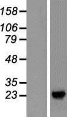 Western Blot: SDF2L1 Overexpression Lysate (Adult Normal) [NBP2-06484] Left-Empty vector transfected control cell lysate (HEK293 cell lysate); Right -Over-expression Lysate for SDF2L1.