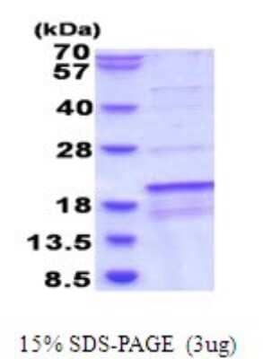 SDS-PAGE Recombinant Human SDH Assembly Factor 1 His Protein