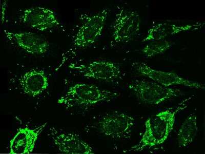 Immunocytochemistry/Immunofluorescence: SDHA Antibody [NBP2-99321] - Immunofluorescence staining of SDHA in Hela cells. Cells were fixed with 4% PFA, permeabilzed with 0.3% Triton X-100 in PBS, blocked with 10% serum, and incubated with rabbit anti-Human SDHA polyclonal antibody (dilution ratio 1:1000) at 4C overnight. Then cells were stained with the Alexa Fluor$488-conjugated Goat Anti-rabbit IgG secondary antibody (green). Positive staining was localized to cytoplasm.