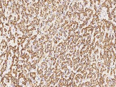 Immunohistochemistry-Paraffin: SDHA Antibody [NBP2-99321] - Immunochemical staining of human SDHA in human liver with rabbit polyclonal antibody at 1:1000 dilution, formalin-fixed paraffin embedded sections.
