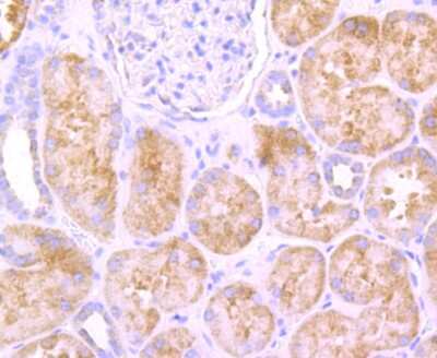 Immunohistochemistry-Paraffin: SDHA Antibody (JM10-83) [NBP2-67130] - Analysis of paraffin-embedded human kidney tissue using anti-SDHA antibody. Counter stained with hematoxylin.