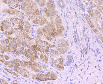 Immunohistochemistry-Paraffin: SDHA Antibody (JM10-83) [NBP2-67130] - Analysis of paraffin-embedded human liver tissue using anti-SDHA antibody. Counter stained with hematoxylin.