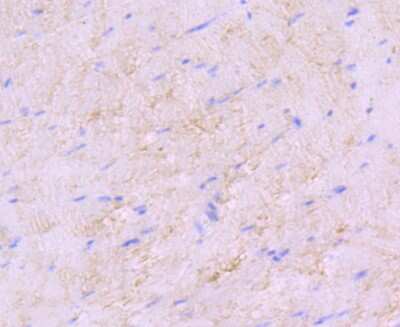 Immunohistochemistry-Paraffin: SDHA Antibody (JM10-83) [NBP2-67130] - Analysis of paraffin-embedded mouse skeletal muscle tissue using anti-SDHA antibody. Counter stained with hematoxylin.