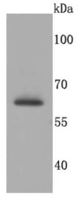 Western Blot: SDHA Antibody (JM10-83) [NBP2-67130] - Analysis of SDHA on Jurkat cells lysates using anti-SDHA antibody at 1/500 dilution.