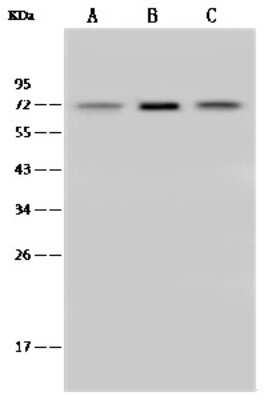 Western Blot: SDHA Antibody [NBP2-99321] - Anti-SDHA rabbit polyclonal antibody at 1:500 dilution. Lane A: MCF7 Whole Cell Lysate Lane B: HeLa Whole Cell Lysate Lane C: Jurkat Whole Cell Lysate Lysates/proteins at 30 ug per lane. Secondary Goat Anti-Rabbit IgG (H+L)/HRP at 1/10000 dilution. Developed using the ECL technique. Performed under reducing conditions. Predicted band size: 72 kDa. Observed band size: 72 kDa